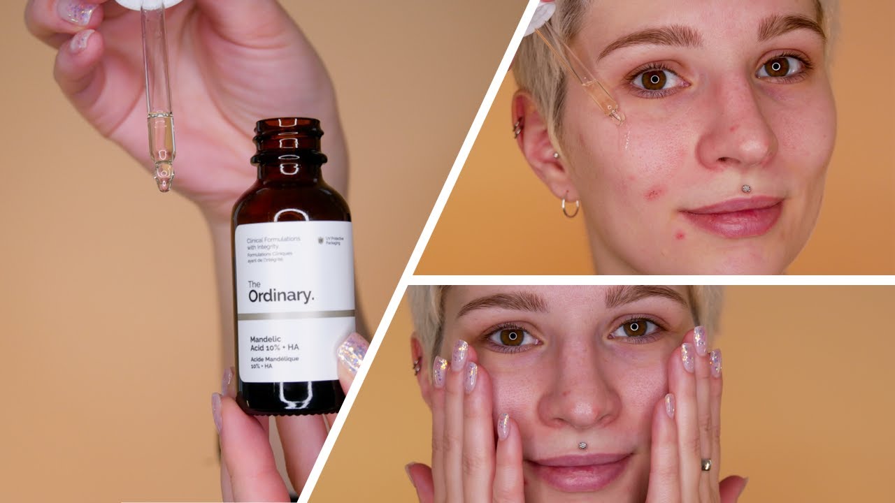The Ordinary Mandelic Acid 10% + HA: Eksfoliasi Lembut untuk Kulit Sensitif